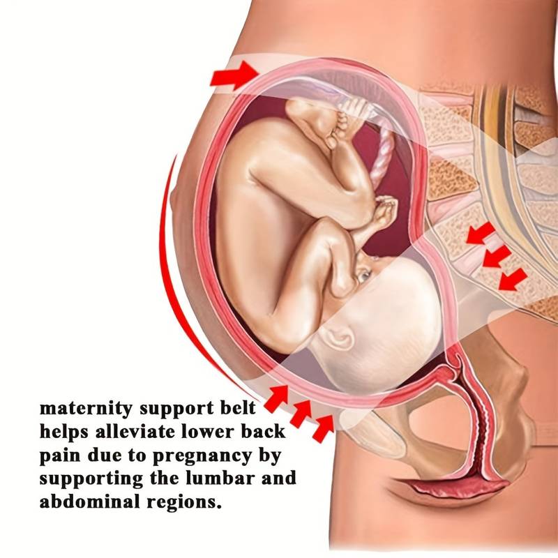 3 in 1 Pregnancy Back Support  Belt Support Child Weight and Relieve Back Preasure 3830-10